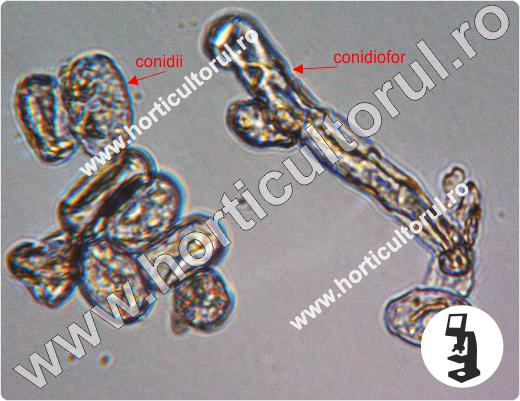 podosphaera leucotricha microscope