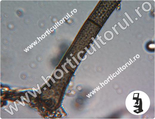 Botrytis cinerea la capsun-conidiofor la microscop
