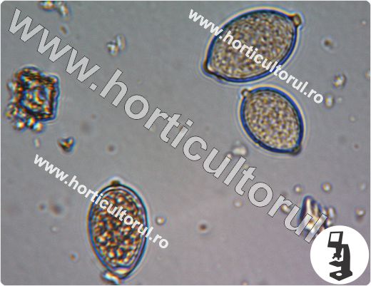 Fig. 7 Phytophthora infestans, conidiofori cu conidii