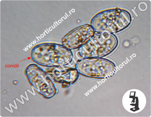 Fainarea gutuiului-Podosphaera clandestina-la microscop
