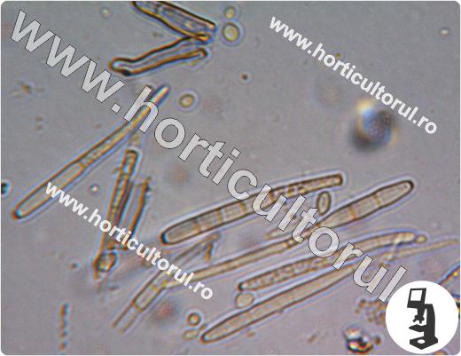 Fig. 1 Cercosporioza sfeclei (Cercospora beticola), conidii